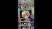 عمل جراحی دکتر رضا اشراقی با دوربین پزشکی Surgical Camera